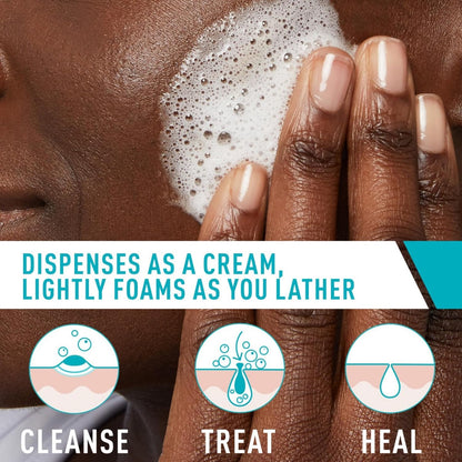 Acne Foaming Cream Cleanser with 4% Benzoyl Peroxide – Gentle Daily Face Wash